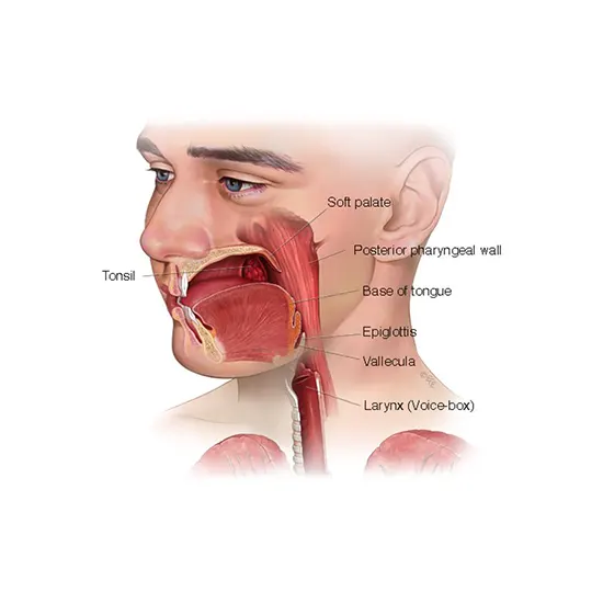 Pharyngeal Cancer - Symptoms, Types, Causes & Diagnosis